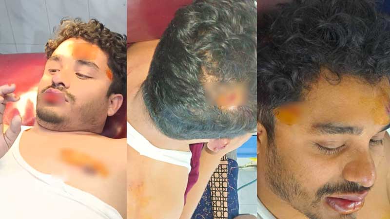 তিতুমীর ছাত্রলীগের হামলায় সাংবাদিক সাব্বির আহমেদ গুরুতর আহত