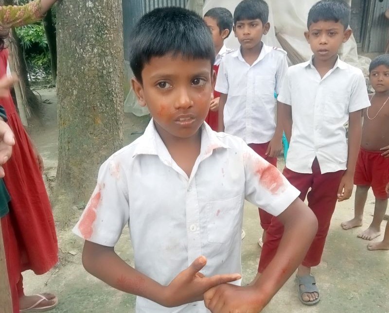 তুচ্ছ ঘটনায় দ্বিতীয় শ্রেণির শিক্ষার্থীর নাক ফাটালেন সহকারি শিক্ষক!