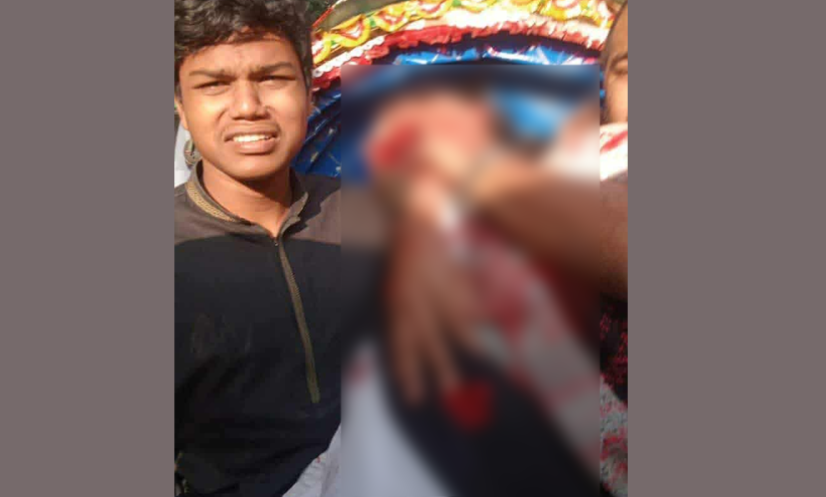 সংকটাপন্ন হাদি: মাথা থেকে গুলি বের করা হলেও মস্তিষ্কে ক্ষতির আশঙ্কা