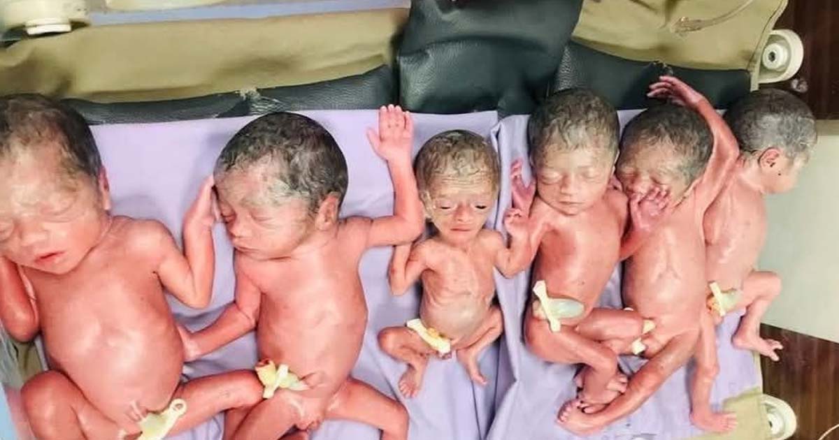 চট্টগ্রামে একসঙ্গে ছয় শিশুর জন্ম দিলেন নারী