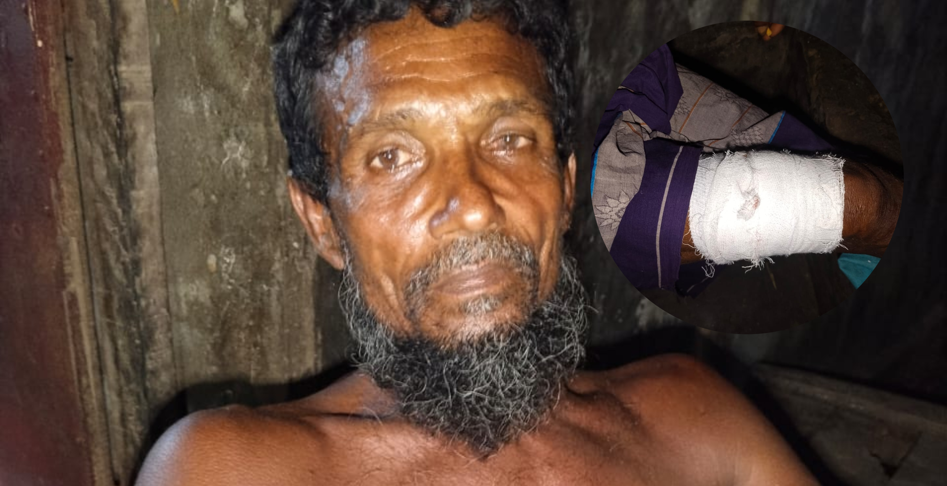 নাফ নদীতে মাছ ধরতে গিয়ে আরাকান আর্মির গুলিতে জেলে আহত