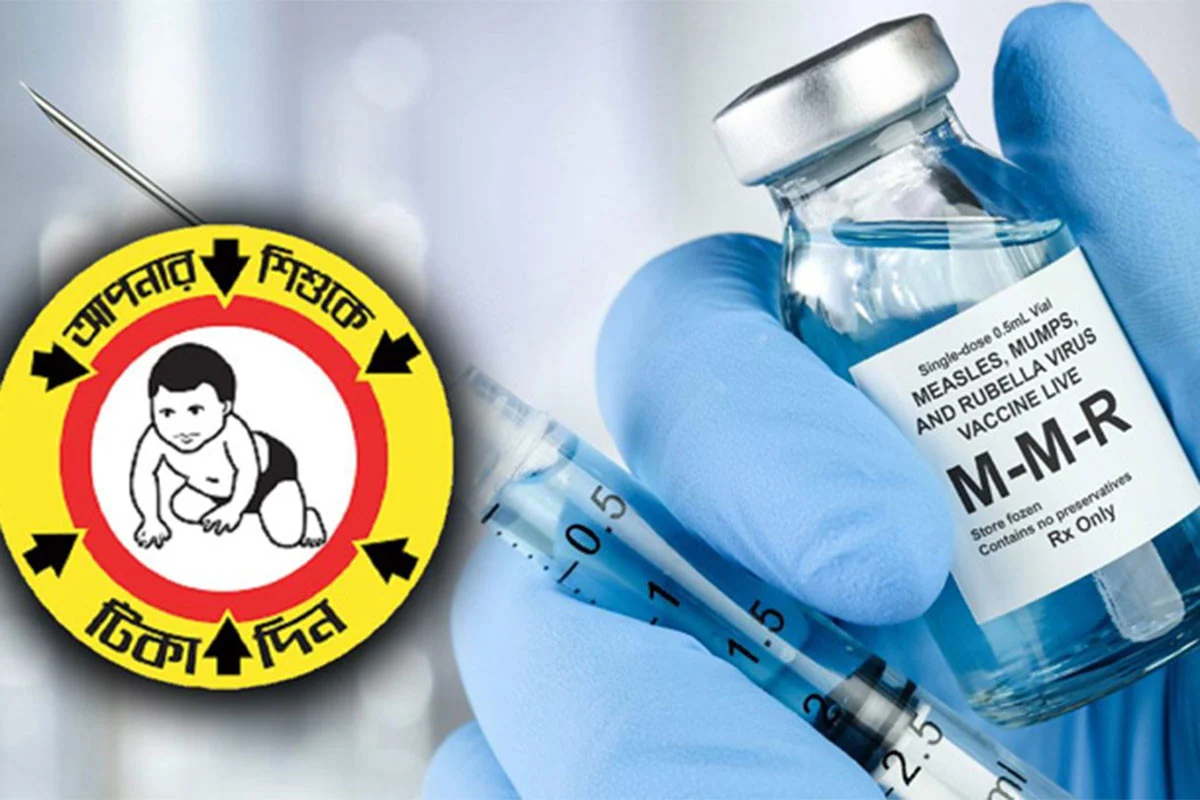 কাল থেকে যে ৩০ উপজেলায় দেয়া হবে হামের টিকা