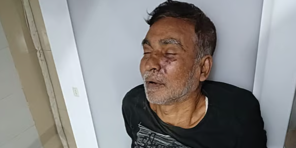 রাজশাহীতে আত্মগোপন থেকে ফিরে বাড়িতে নির্যাতনের শিকার হয়ে আওয়ামী লীগ নেতার মৃত্যু