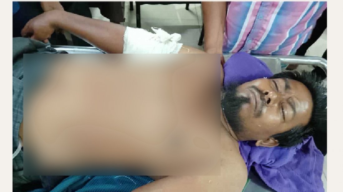 গোপালগঞ্জে রিকশাচালক গুলিবিদ্ধ, ঢামেকে চিকিৎসাধীন