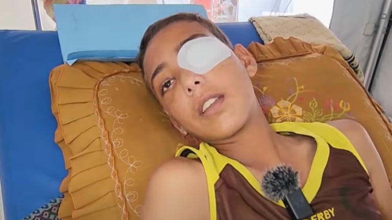 খাবারের খোঁজে গিয়ে গুলিবিদ্ধ ফিলিস্তিনি কিশোর, চোখ হারানোর শঙ্কা