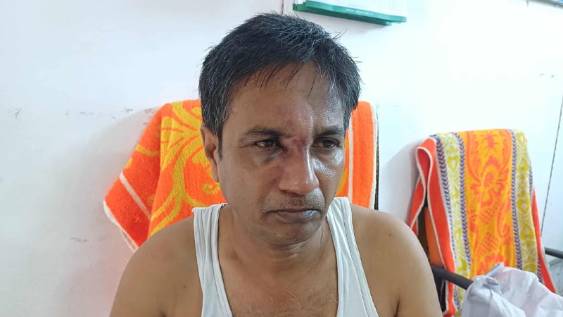 পটিয়ায় প্রধান শিক্ষকের ওপর সন্ত্রাসী হামলা